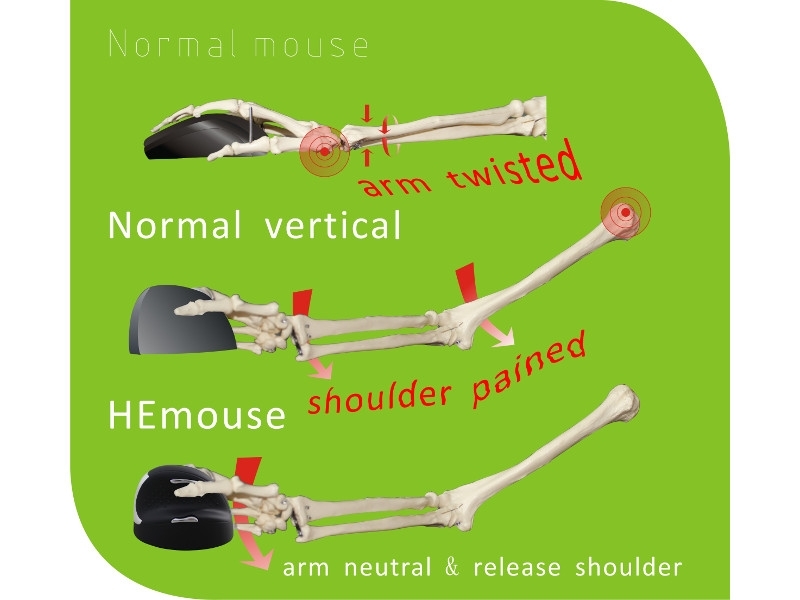 R-Go HE Mouse Break ergonomische Maus M rechts RGOBRHESMR, ergonomisches Arbeiten